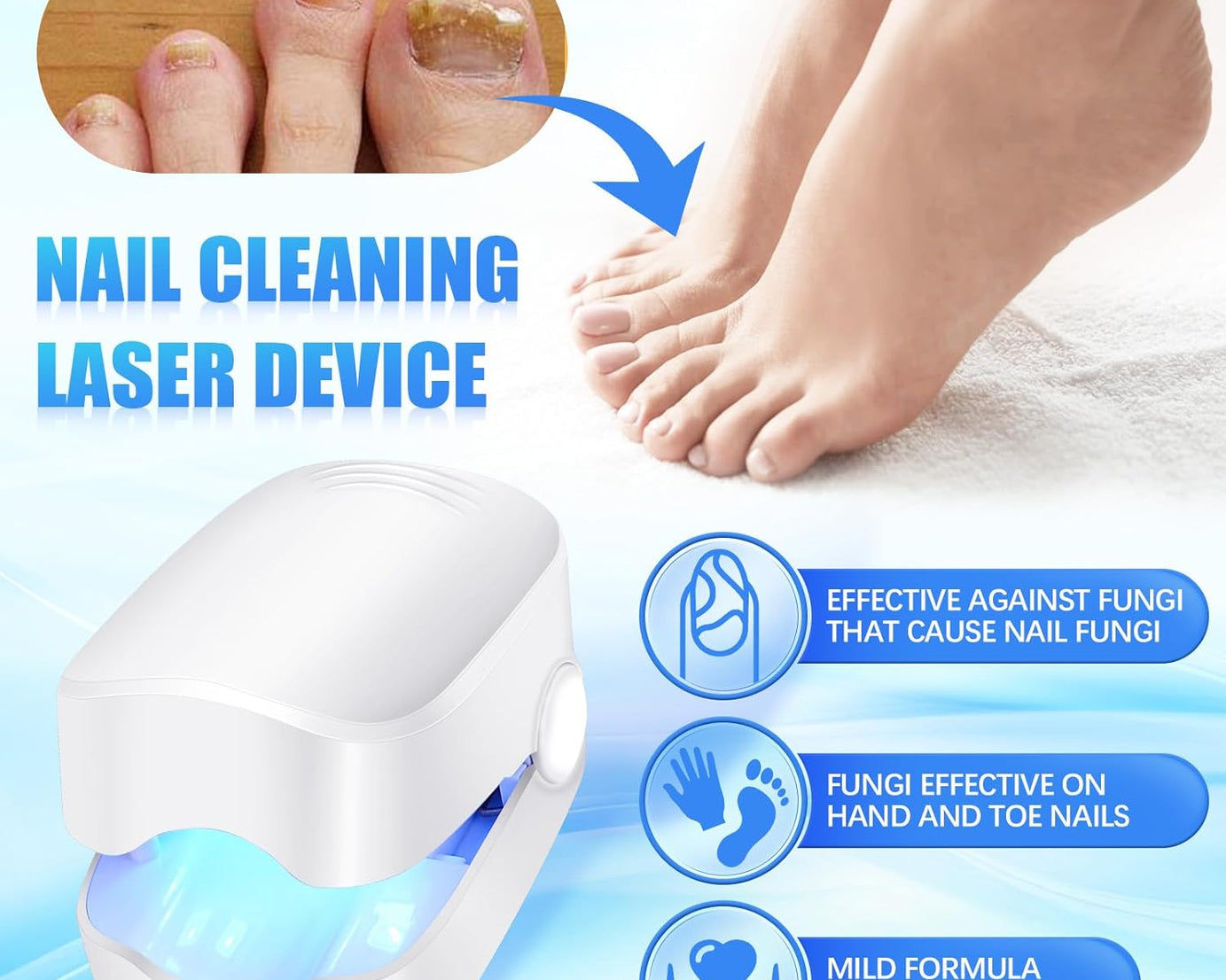 Rechargeable Nail Fungus Treatment for Toenail, Toe Nail Fungal Treatment Nail Fungus Laser Device, Anti-Fungal Nail Treatment for Hand & Feet Infections Remover for Home Use