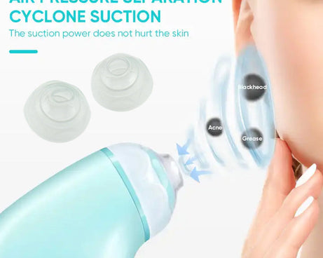 Vacuum Blackhead Machine, Reduce Spot Mini Handheld Lifting Massage Facial Blackhead Remover For Skin Care (1 Pc)