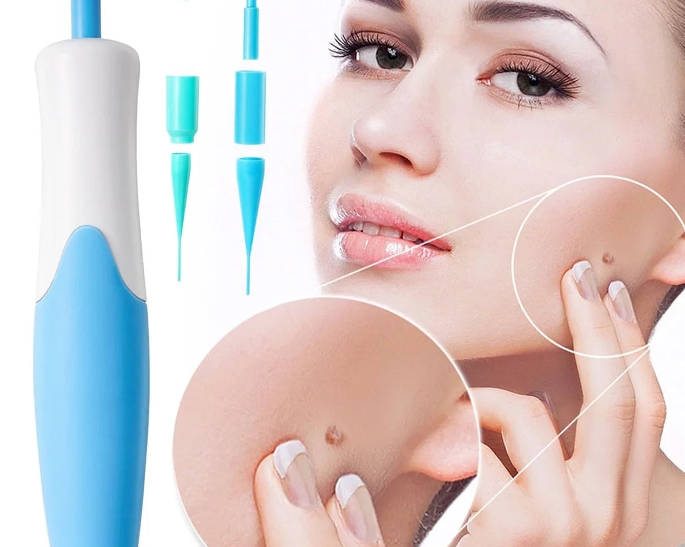 Skin Tag Remover Kit