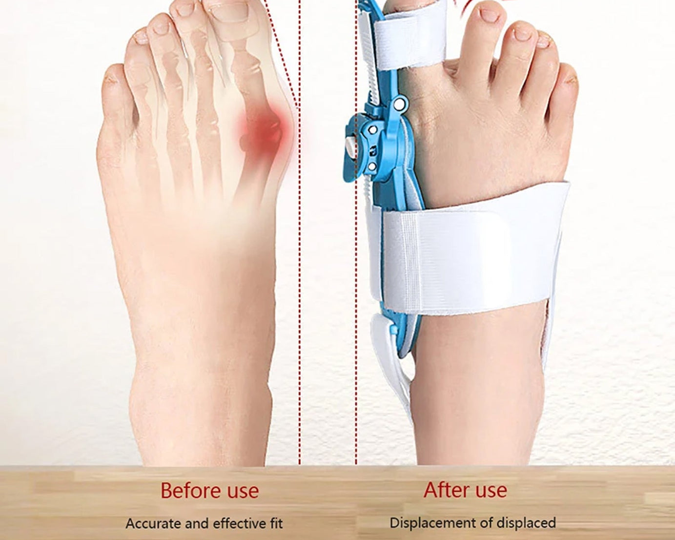 Bunion Support Splint. Valgus And Bunion Valgus, Corrector, Hallux Valgus Corrector, Adjustable Bunion Valgus Protective Cover For Men And Women