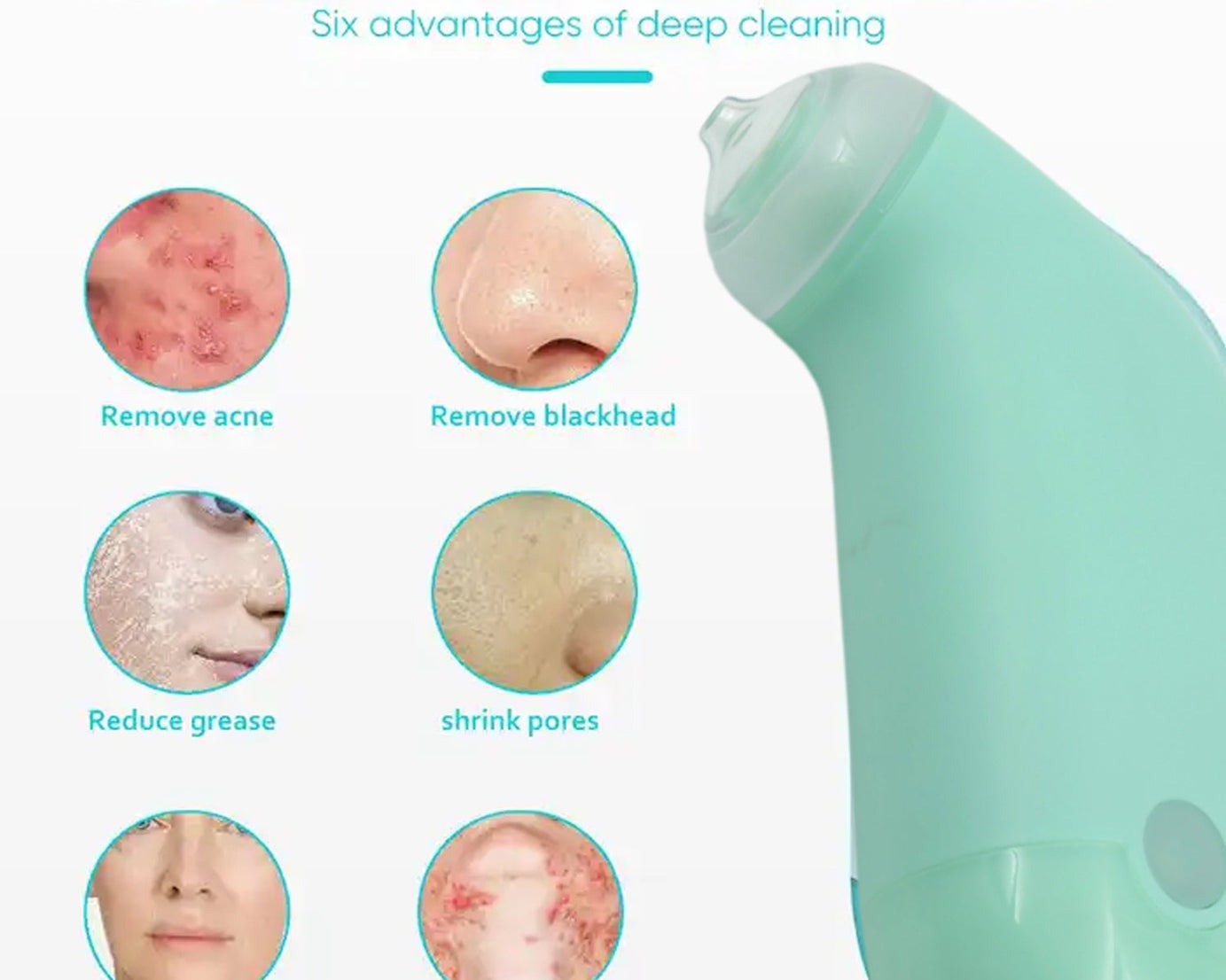 Vacuum Blackhead Machine, Reduce Spot Mini Handheld Lifting Massage Facial Blackhead Remover For Skin Care (1 Pc)