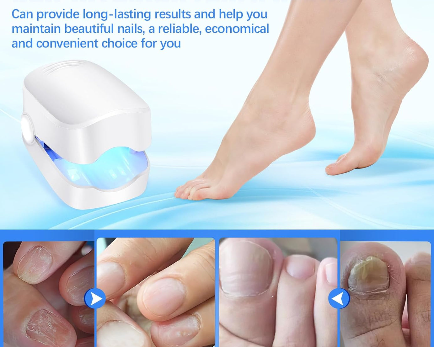 Rechargeable Nail Fungus Treatment for Toenail, Toe Nail Fungal Treatment Nail Fungus Laser Device, Anti-Fungal Nail Treatment for Hand & Feet Infections Remover for Home Use