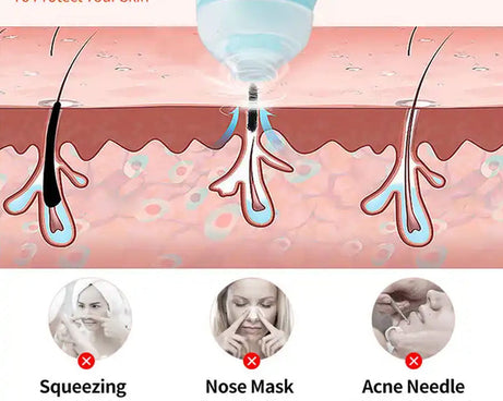 Vacuum Blackhead Machine, Reduce Spot Mini Handheld Lifting Massage Facial Blackhead Remover For Skin Care (1 Pc)