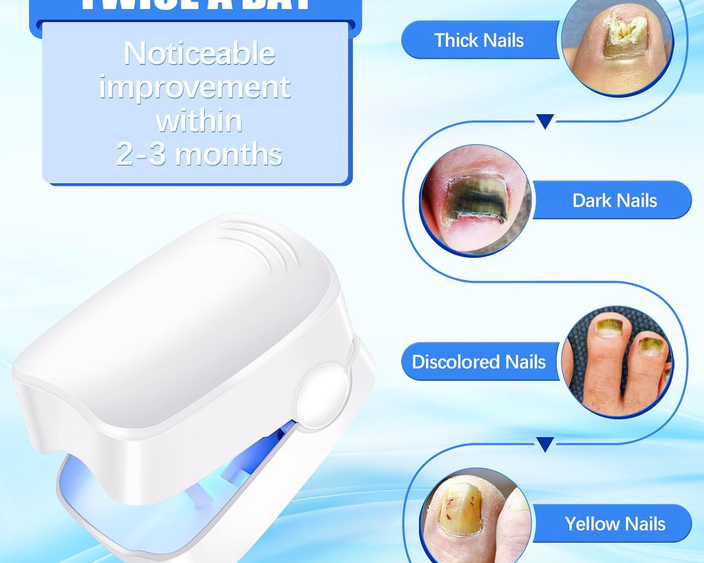 Rechargeable Nail Fungus Treatment for Toenail, Toe Nail Fungal Treatment Nail Fungus Laser Device, Anti-Fungal Nail Treatment for Hand & Feet Infections Remover for Home Use