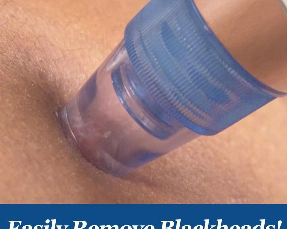 Pore cleaner tool for blackheads and acne.