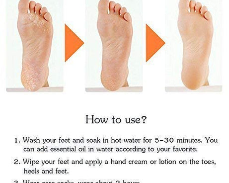 Silicone gel socks for anti-crack foot protection.