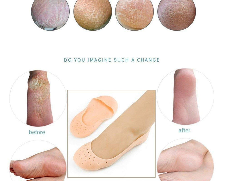 silicone gel foot protectors for moisturizing.