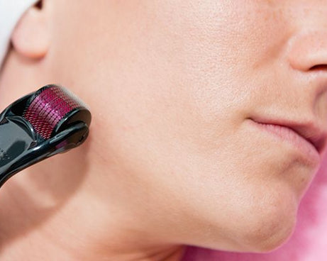 Skin treatment roller